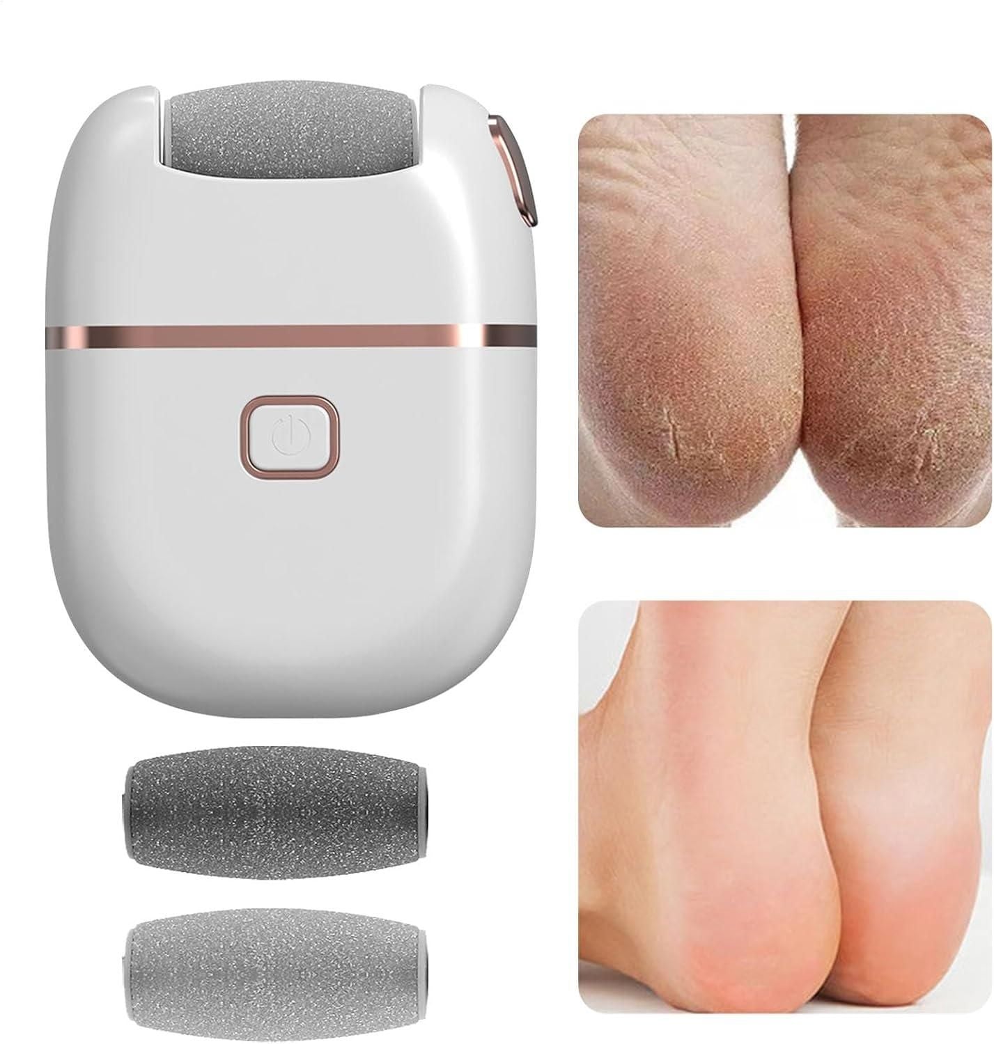 SmoothStep – Electronic Pedicure Tool