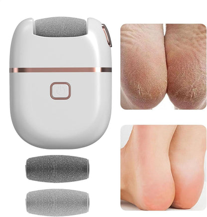SmoothStep – Electronic Pedicure Tool