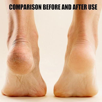SmoothStep – Electronic Pedicure Tool