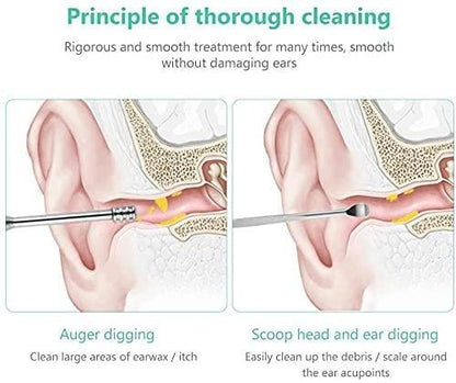 ClearHear 6-in-1 Stainless Steel Ear Wax Removal Kit